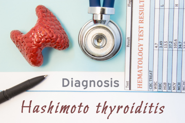 So, You’ve been diagnosed with Hashimoto’s, what now?